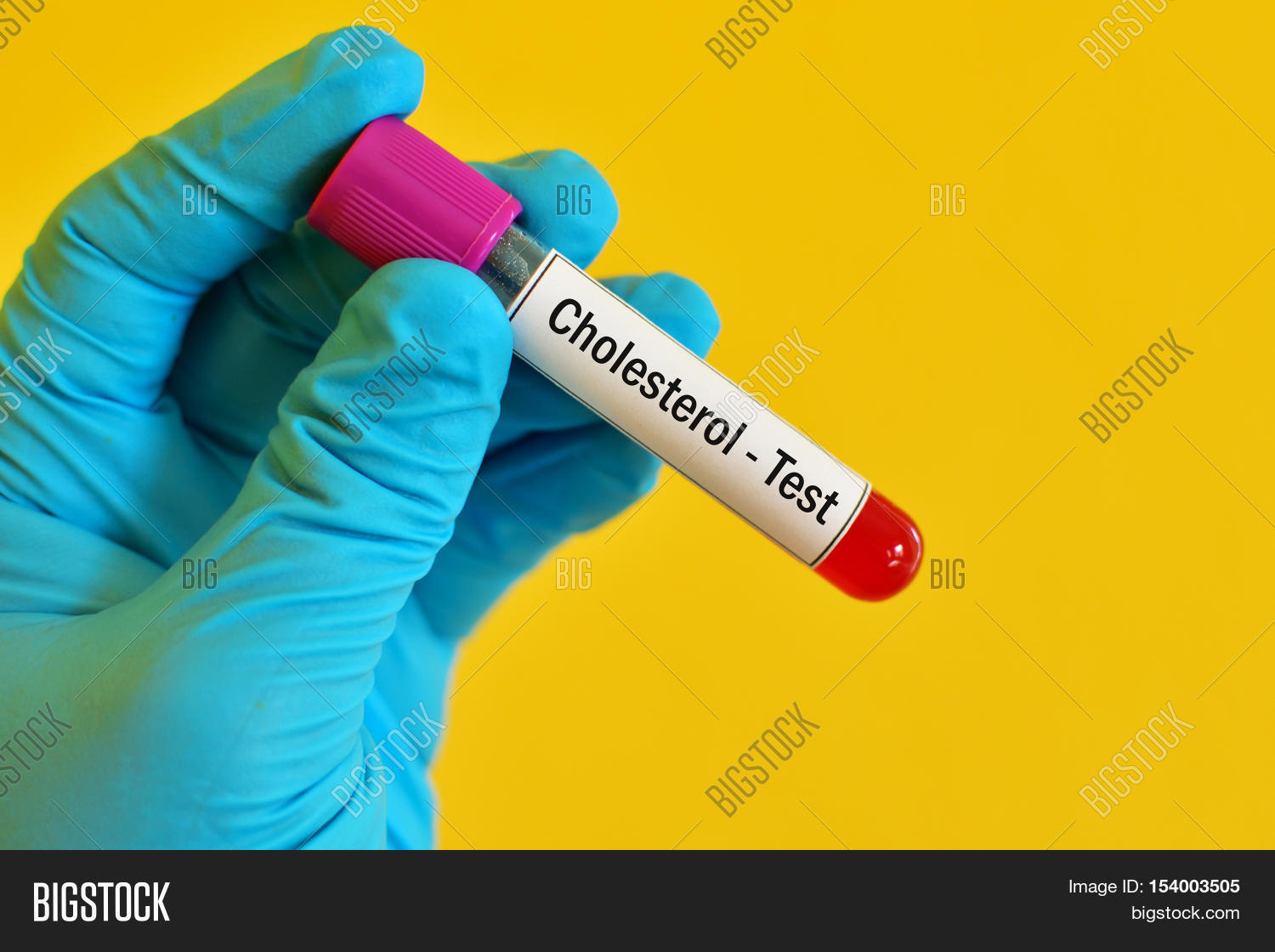 Test Tube Blood Sample Cholesterol Image & Photo Bigstock