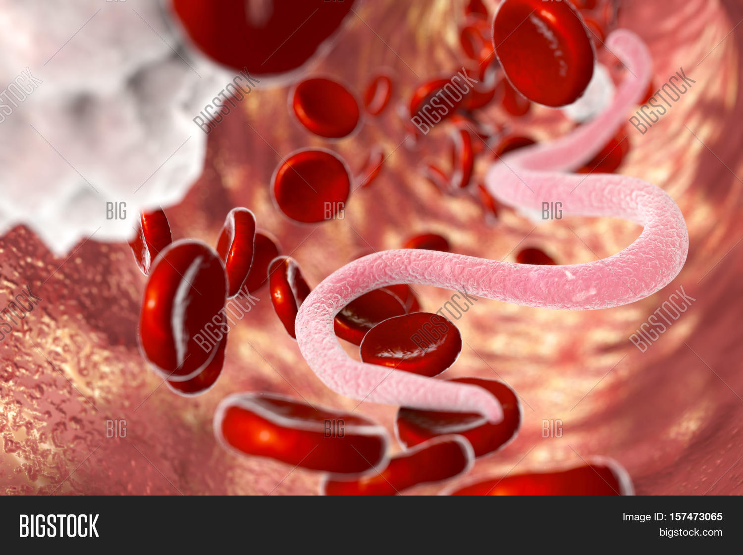 Parasitic Worms Blood, 3D Image & Photo Bigstock