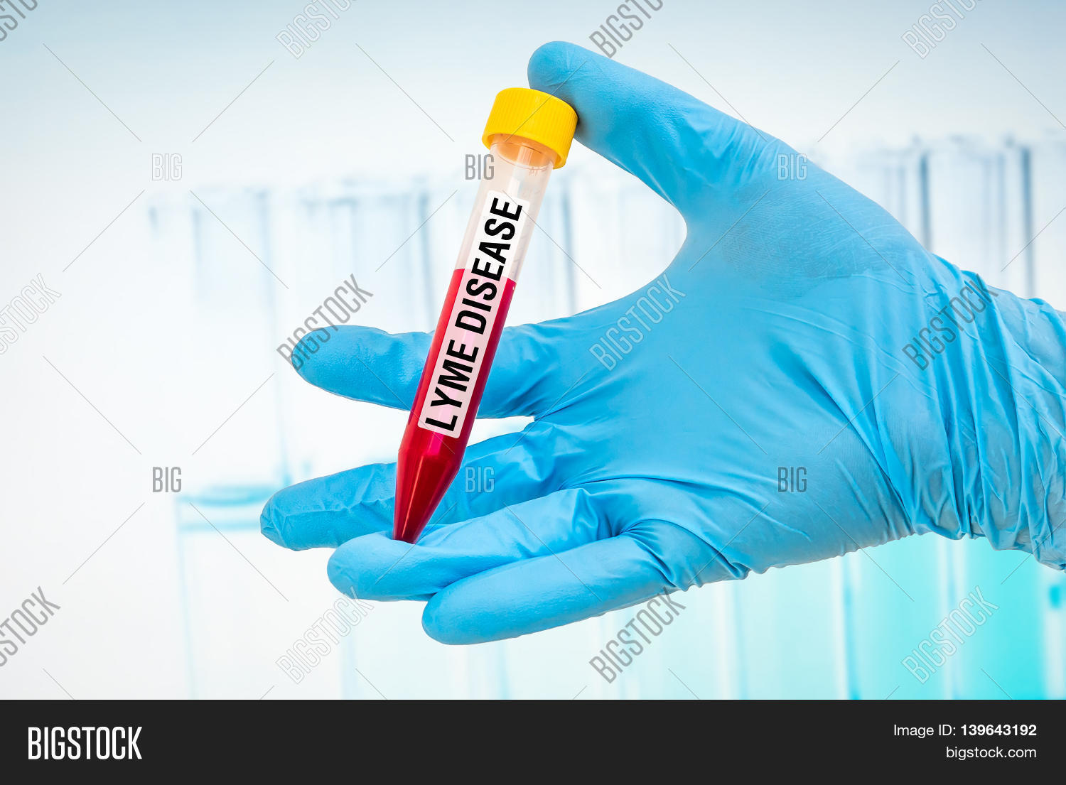 Testtube Blood Sample Lyme Disease Image & Photo Bigstock