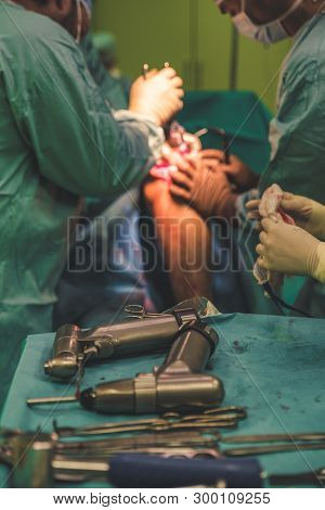Orthopedic Surgery  At Operating Theater. Knee Endoprosthesis Implant