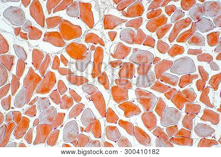 Cross Section Muscle Skeleton Micro Preparation Samples- Section (tissue) Under Microscope View. His