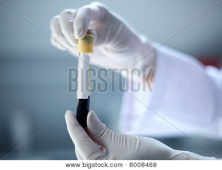 Verikoe