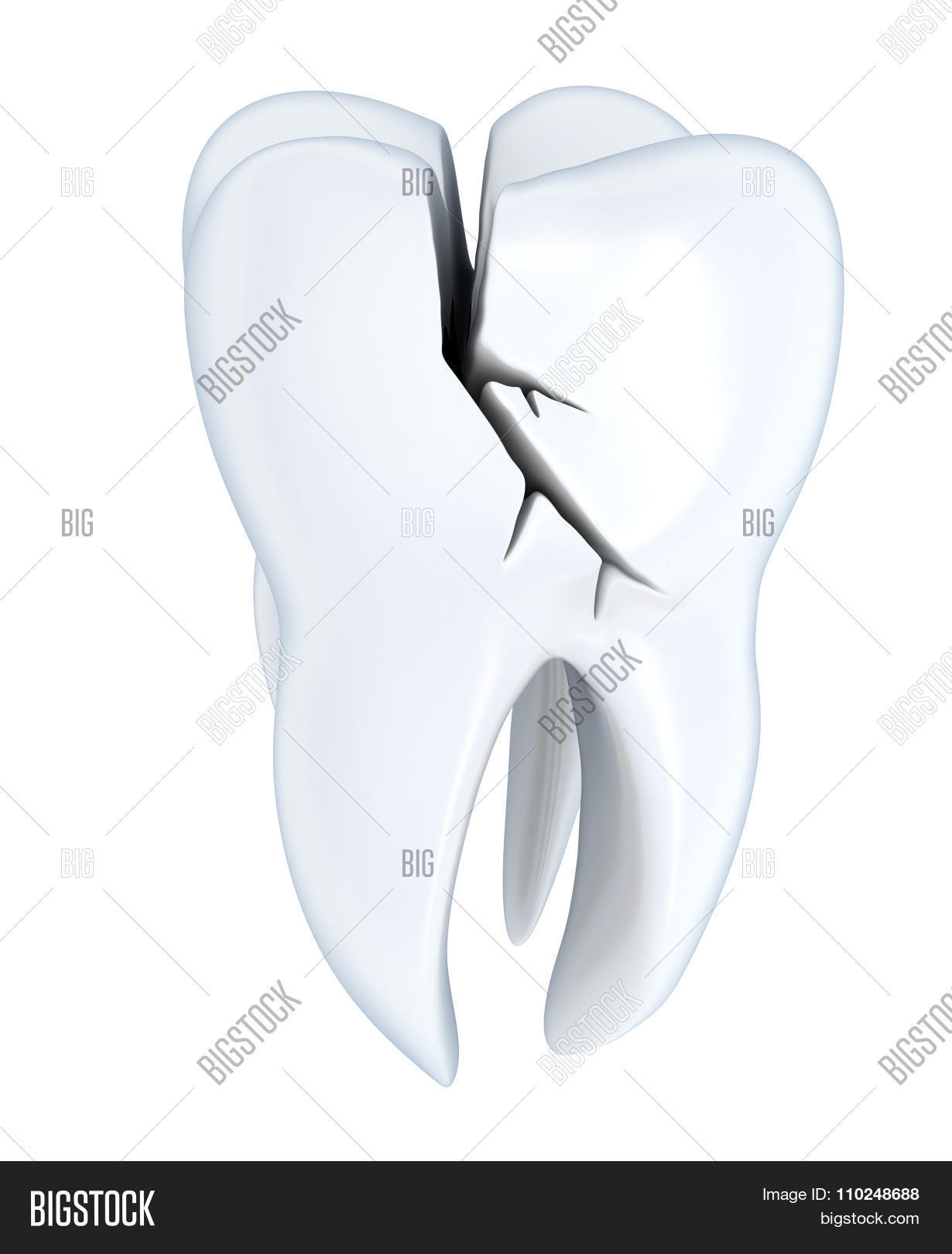 Broken Tooth Image & Photo (Free Trial) | Bigstock