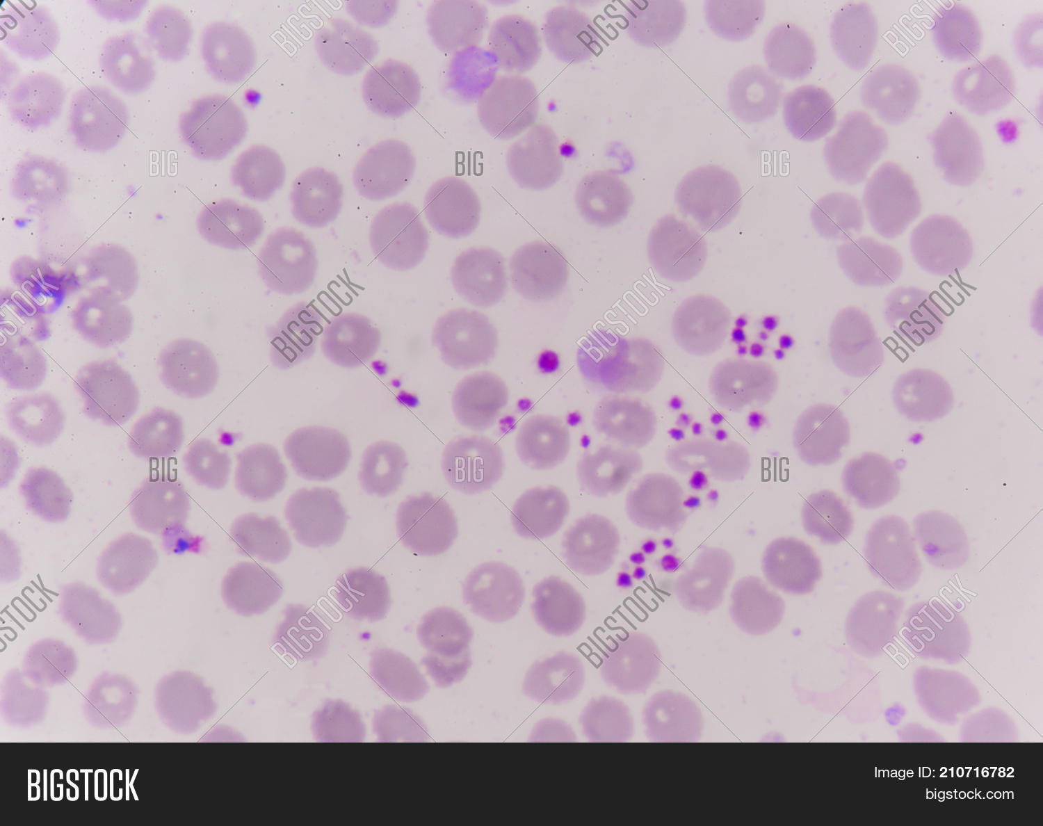 Platelet Clumping Image & Photo (Free Trial) Bigstock