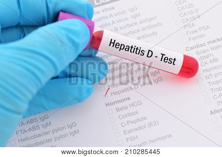 Blood sample with requisition form for hepatitis D virus test