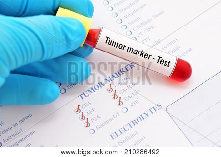 Blood sample with requisition form for tumor marker test