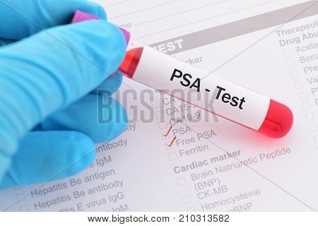 Blood sample with requisition form for PSA test