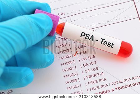 Blood sample with requisition form for PSA test
