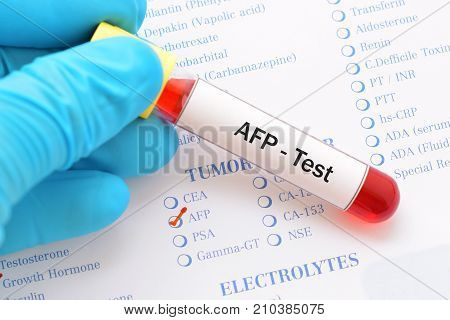 Blood sample with requisition form for AFP test