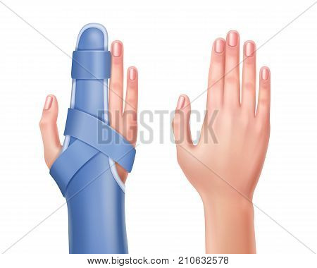 Vector empty hand and trauma of hand with finger in splint. isolated on white background