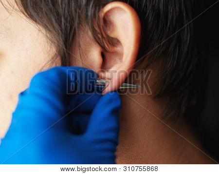 Piercing And Stretching The Ears With Medical  Blue Gloves. Increase The Diameter Of The Ear Tunnels