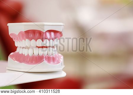 Closeup Model Of A Human Jaw With White Teeth. Jaw In Dentistry. Copy Space. Clean Denture, Model Of