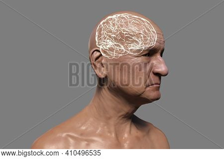 Dementia, Conceptual 3d Illustration Showing An Elderly Person With Progressive Impairments Of Brain