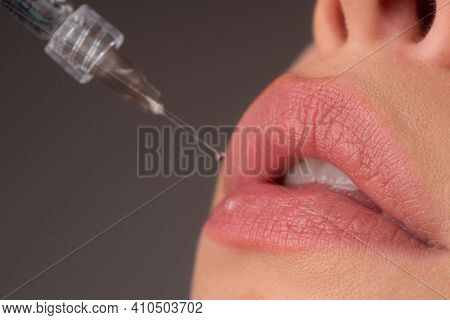 Closeup Of Lips Augmentation. Syringe Female Mouth. Cosmetology Treatment. Hyaluronic Acid Injection