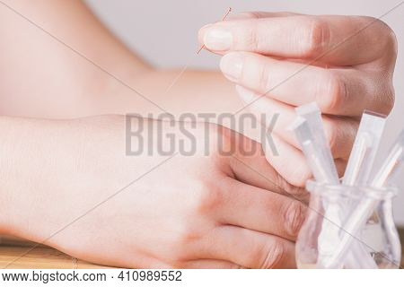 Hand applying acupuncture needle in a point called Hegu. 
