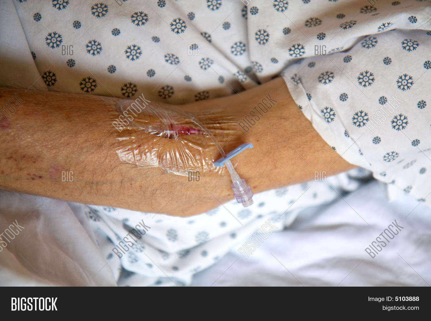 Intravenous Needle Arm Image & Photo (Free Trial) Bigstock
