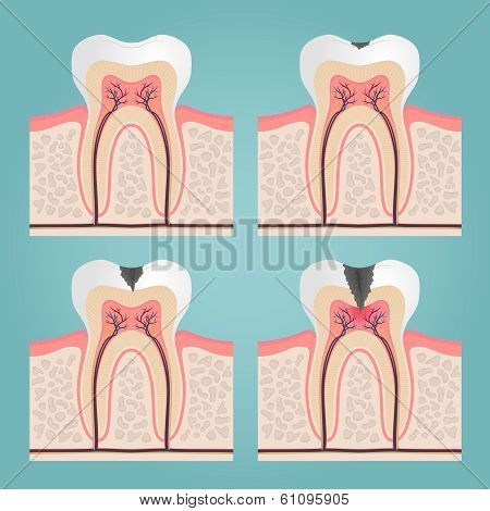 tooth anatomy