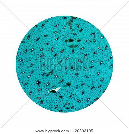 Stoma Micrograph