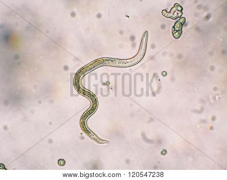 Toxocara canis second stage larvae hatch from eggs
