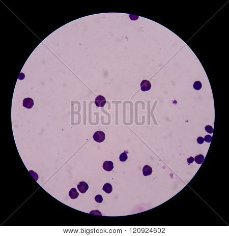 Mesothelial Cells