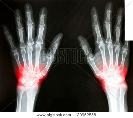 Photo of a film X-Ray scan human