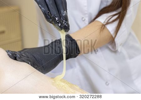 Beautician Depilating Womans Legs With Liquid Sugar In Spa Center. Depilation Of Legs With Sugar Pas