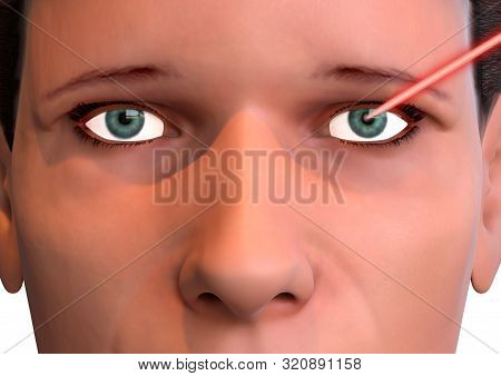 Correction Of The Vision Of The Human Eye By A Laser Beam. Modern Treatment Of Ophthalmology
