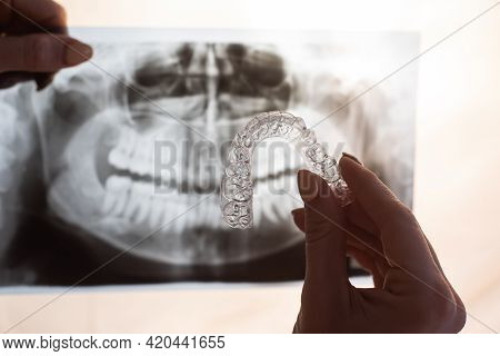 Female Hands With Transparent Mouth Guards For Correcting Bite And X-ray Of The Jaw. The Orthodontis