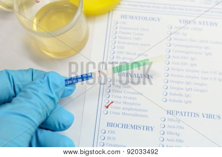 Urine testing