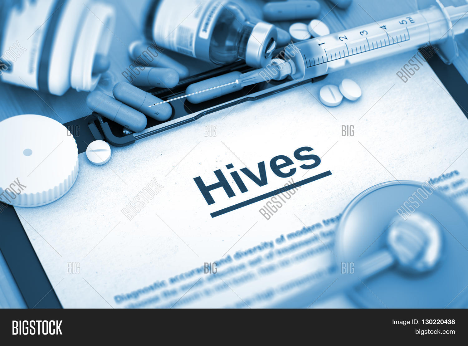 Hives, Medical Concept Image & Photo (Free Trial) Bigstock