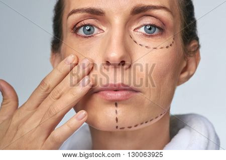 mid age woman with correction mark for plastic cosmetic surgery, vanity perfection