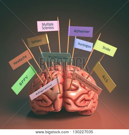 Image of a brain on the table with various nameplates of various diseases that can affect our brain. It's a 3D image with nameplates stuck by toothpick. Clipping path included.