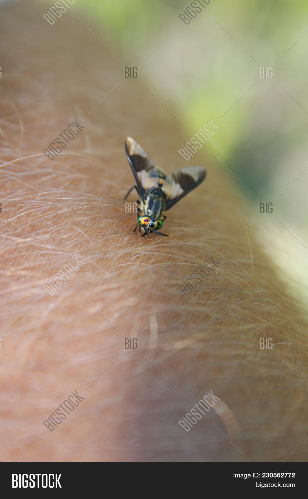 Horsefly Bites Human Image & Photo (Free Trial) Bigstock