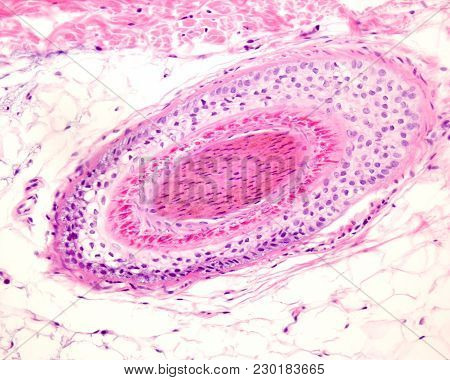 Hair Follicle