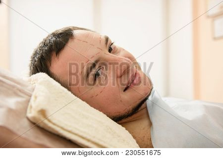 Patient Lay Down At Couch At Beauty Surgery Hospital. Man Face With Medical Contours At Skin
