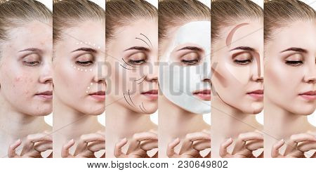 Beautiful Woman Step By Step Improves Her Skin Condition. Skin Care Concept.