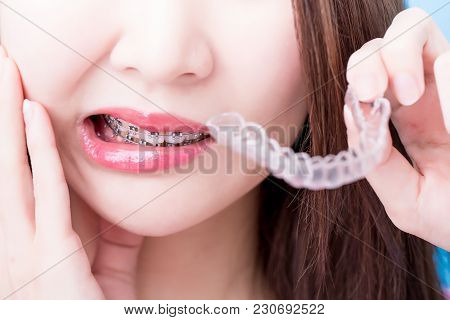 Woman Wear Beace And Take Invisible Braces For Your Health Concept