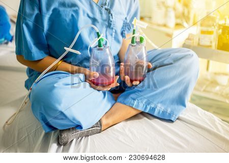 The Woman Patient Is On The Bed In The Hospital After Her Surgery With The Tube And Bottles To Drain