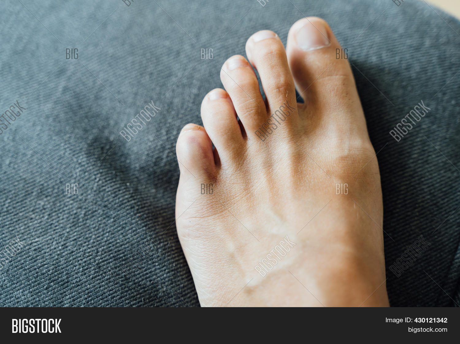 Foot Little Finger Image & Photo (Free Trial) Bigstock