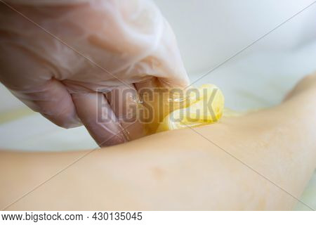 Applying Sugar Paste To Remove Hair. The Process Of Removing Hair From The Legs. The Sugaring Master