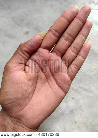 Hand Large Nail And Hand Fingers Photos  Selective Focus