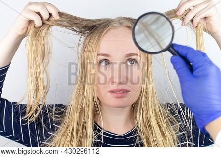 The Girl Looks In Front Of The Magnifier At Her Oily Hair. Problematic Scalp And Increased Secretion
