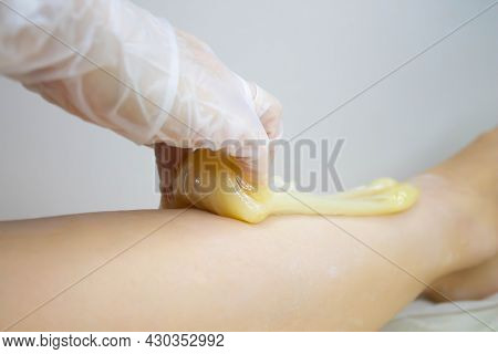 Applying Sugar Paste To Remove Hair. The Process Of Removing Hair From The Legs. The Sugaring Master