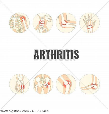 Vector Illustration On The Theme World Arthritis Day
