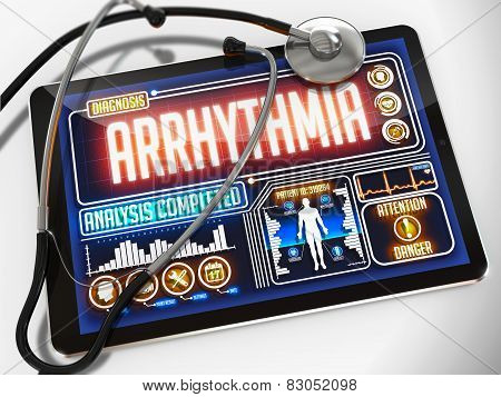 Arrhythmia on the Display of Medical Tablet.