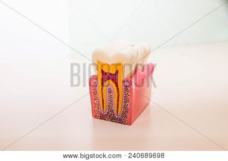 Tooth Model Without Caries, Tooth Decay In Dentist's Office. Healthy Teeth Concept . Children's Dent