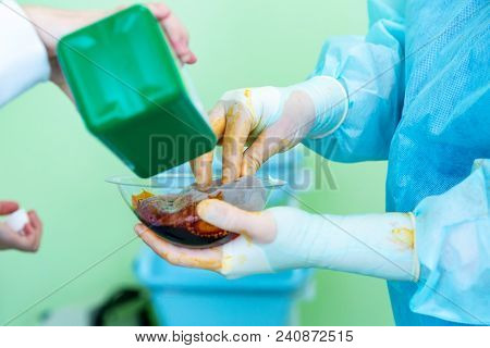 Surgeon Preparing Breast Silicone Implant For The Operation Of Breast Augmentation