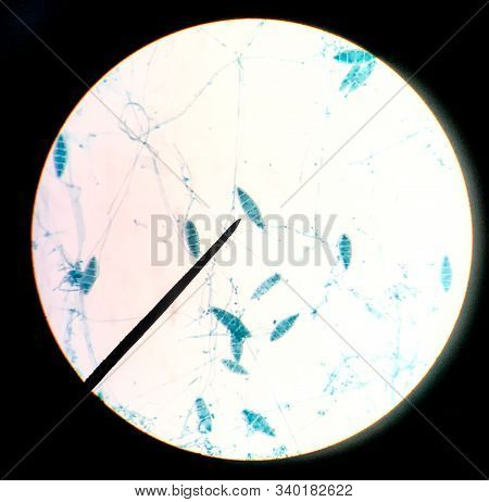 Close Up Macro Conidia Of Fungi.education Concept.