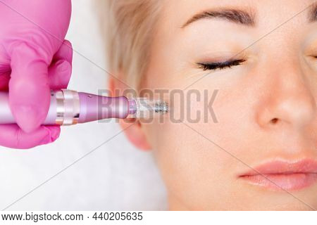 Anti-aging Treatment And Face Lift. Close Upportrait Of Adult Woman At A Mesotherapy Procedure In Co