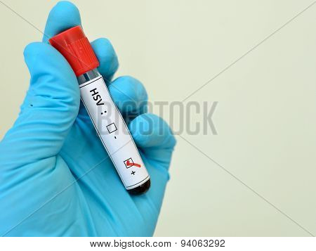Herpes positive